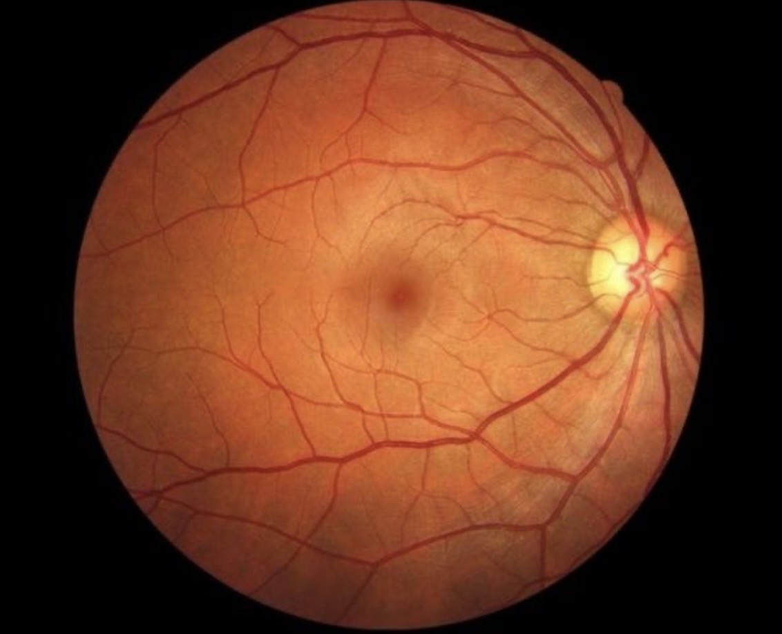 Visita oculistica: immagine illustrativa